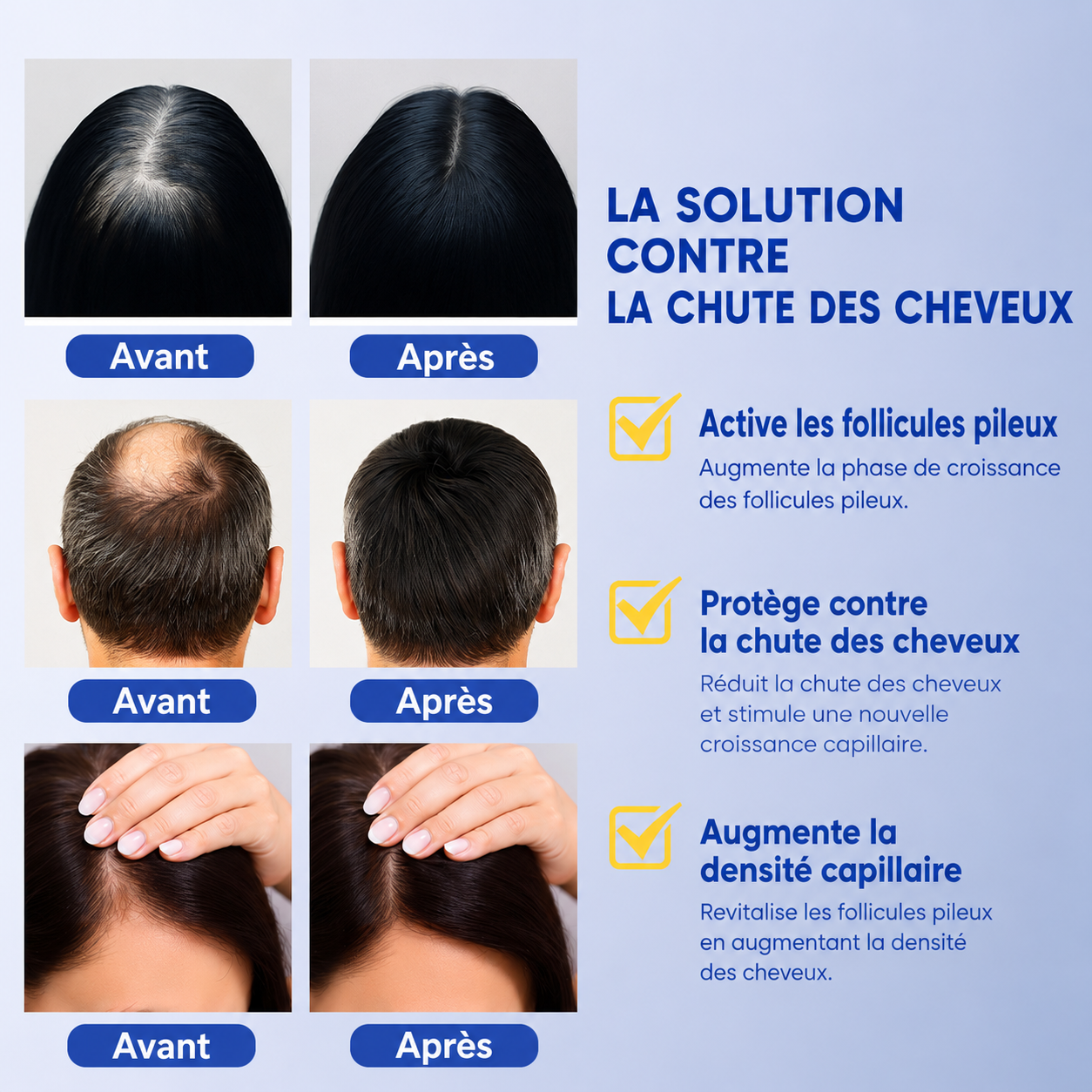 Serum pousse de cheveux